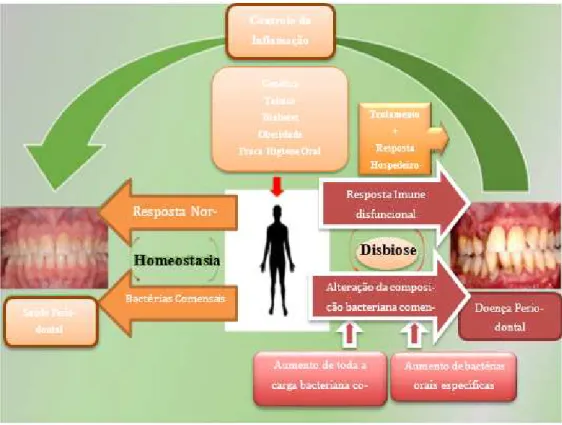 Figura 2 - Saúde periodontal e doença em função da comunidade oral periodontal e a resposta do hos- hos-pedeiro