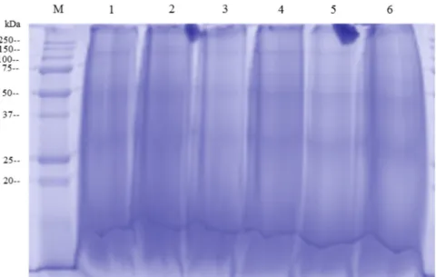 Figura  7.1  -  Gel  de  SDS-PAGE  do  extrato  proteico  obtido  de  fezes.  O  gel  foi  corado  com  Coomassie  blue