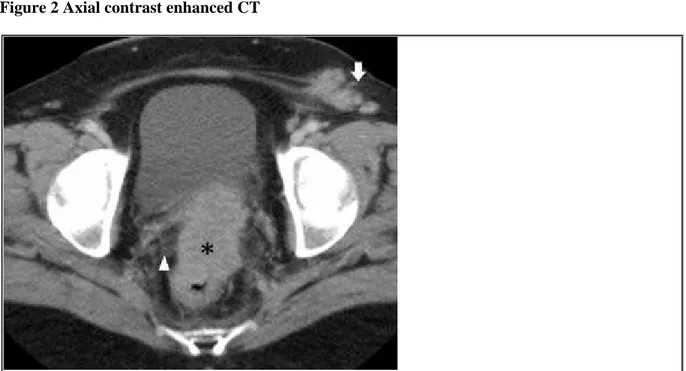 Figure 2 Axial contrast enhanced CT