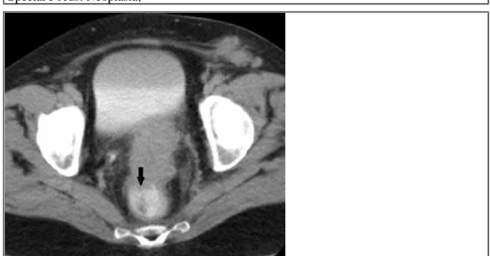 Figure 3 MRI