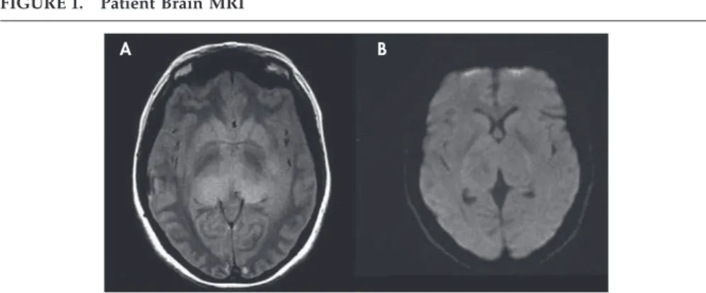 FIGURE 1. Patient Brain MRI
