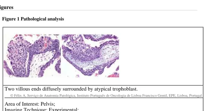 Figure 1 Pathological analysis