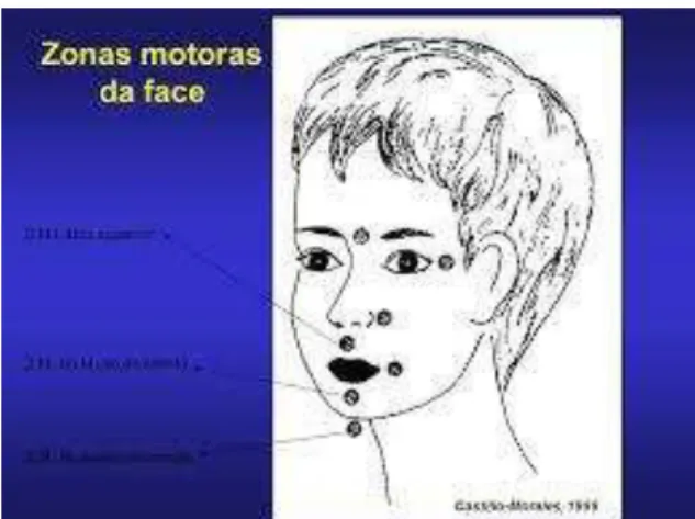 Figura 4- Zonas Motoras da Face ( www.castillomoralesvereinigung.de) 