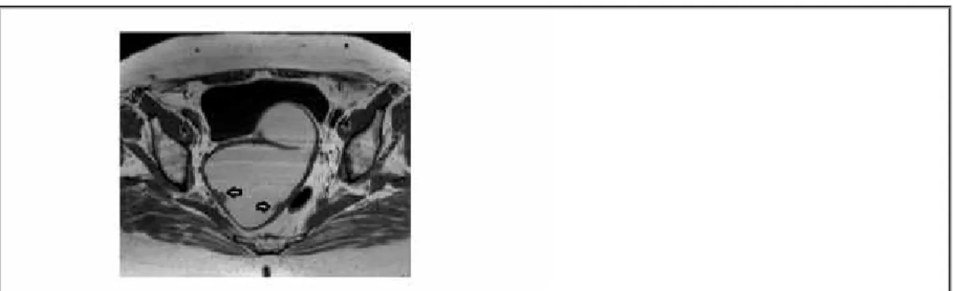 Figure 1 Figure 1 Pelvic MR
