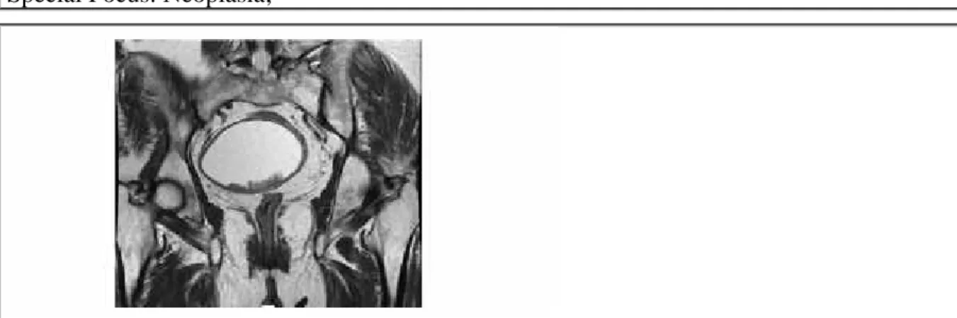 Figure 3 Figure 3 Pelvic MR