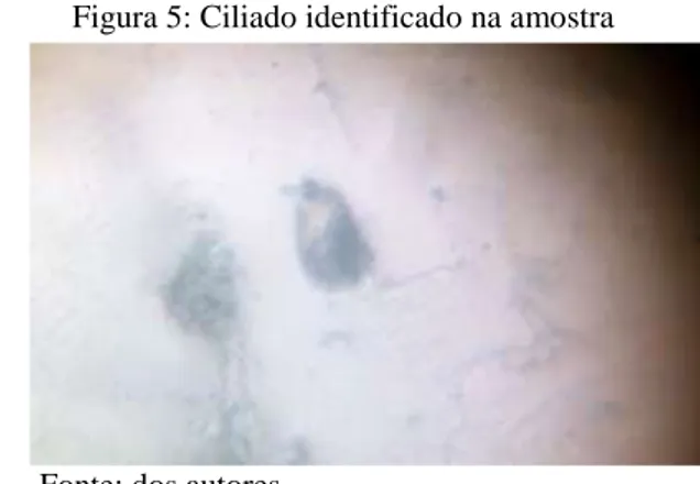 Figura 4: Rotífero identificado na amostra                      Figura 5: Ciliado identificado na amostra 