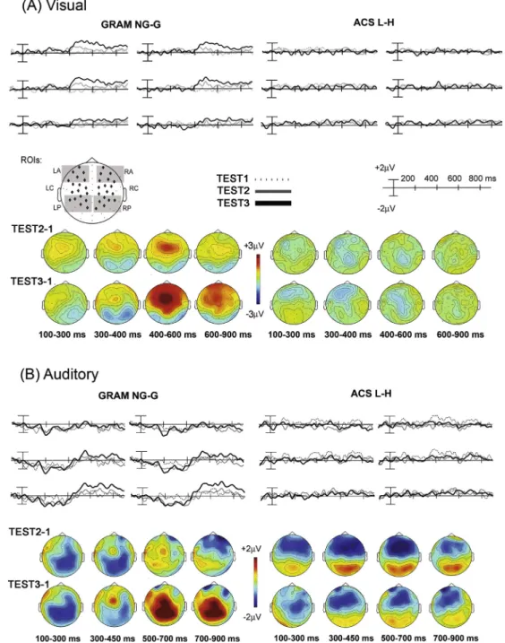 Fig. 4. Learning-related ERPs in visual and auditory (Silva et al., 2017) grammars. Top A and Top B: Average difference waves at the six regions of interest (ROIs) for grammatical status (grammatical status) and ACS effects across the three tests (NG, non-