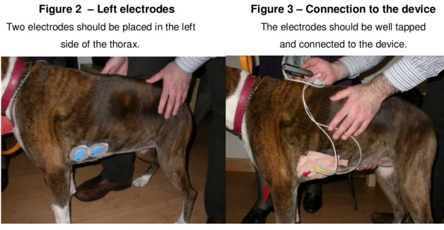 Figure 4 – Right electrode  Figure 5 – Holter ready 