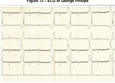 Figure 13 – ECG of George Phillips 