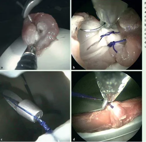 Fig. 5 Ex vivo steps of a complete single-layer, end-to-end esophago-esophageal anastomosis: