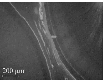 Fig. 2 e Section of the canine root (left) and lateral incisor (right) with crestal bone in between, at the control side