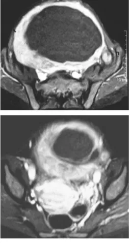 Figure 3 Contrast-enhanced T1-weighted fat-suppressed transaxial images. 