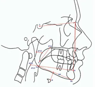 Figura 5 - Locais de obstrução da via aérea observáveis na cefalometria. Adaptado de Fleisher &amp; Krieger,  (2007)