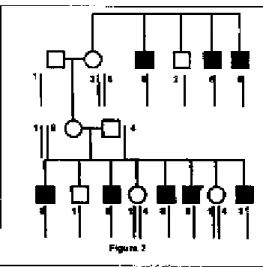 Figura 2: Esquema de uma análise de ligação entre um marcador do cromossomo X e uma doença de herança recessiva ligada ao X (neste caso, só afeta homens e o gene alterado é transmitido por mulhe-res clinicamente norrnais) 