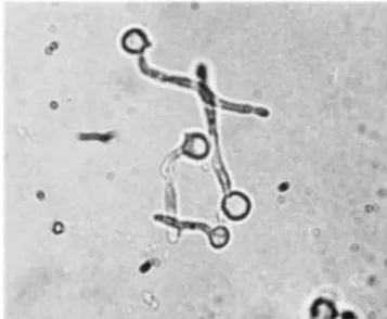 Figura 1 - Tubos germinativos presentes em Candida albicans [retirado de Williams 