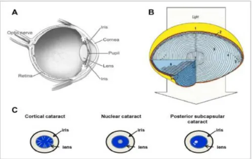 Figura 2   Constituição da lente e formação da catarata  Fonte: Weikel, Garber, Baburins &amp; Taylor (2014) 