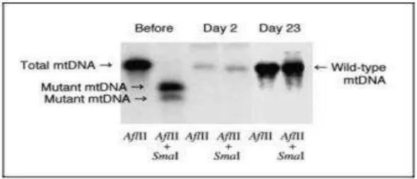 Figura 5 – Análise de Southern blot das amostras de ADN  Fonte: (Tanaka et al., 2002) 