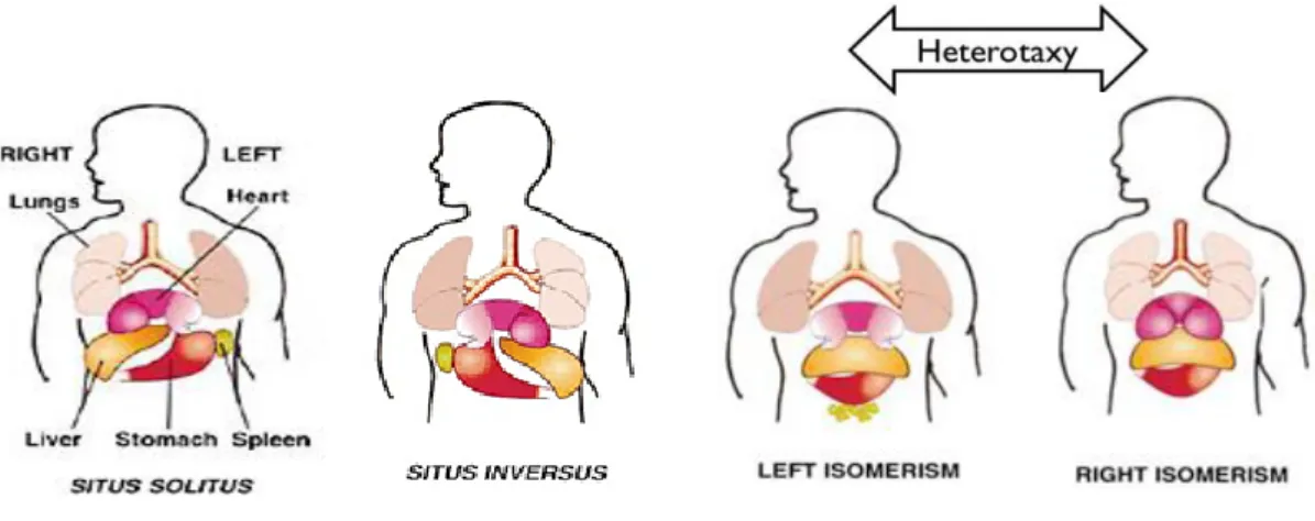 Figure 1.17 – Human laterality defects. 