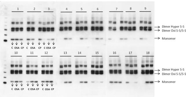 Figure  4.1:  RBCs  results  of  PRDX2  Western  blot  detection  using  the  ECL  system  and  imaging by X-ray processor