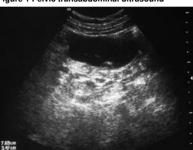 Figure 1 Pelvic transabdominal ultrasound 