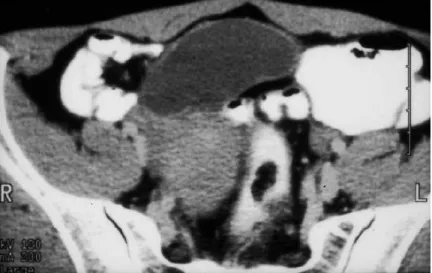 Figure 3 Gross specimen 