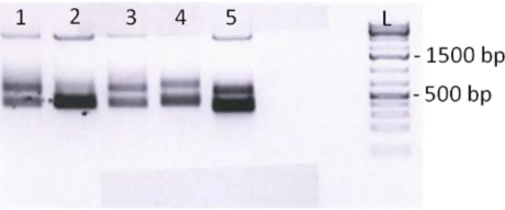 Fig 4. 3: Probes for the ISH method (5  l of each probe) in a 1.5% agarose gel in 1X TAE, stained with  EtBr