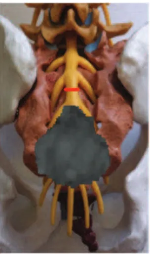 Figure 8: Sot tissues intentionally let behind and included in the specimen to be resected.