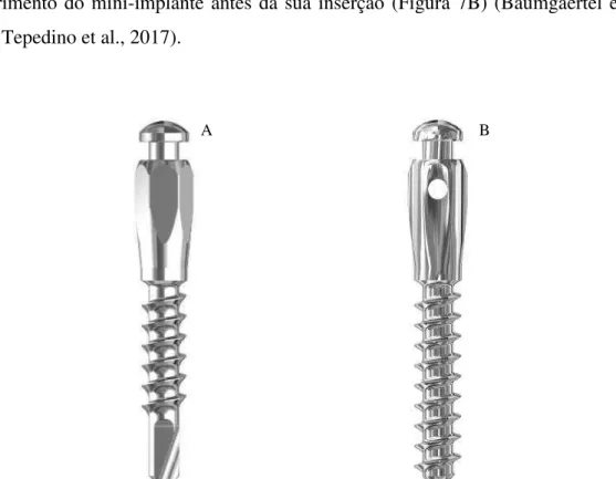 Figura  7.  Tipos  de  mini-implantes.  A  –  Mini-implantes  auto-perfurantes.  B  –  Mini-implantes  auto- auto-rosqueantes