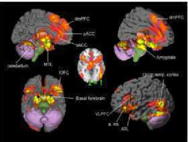 Figura 1 - Espaço de referência neural para uma emoção discreta. Segundo Edelman, um conjunto de  regiões neuronais ativas consistentemente em todos os estudos referentes à avaliação da expriência ou  percepção de raiva, desgosto, medo, felicidade e triste