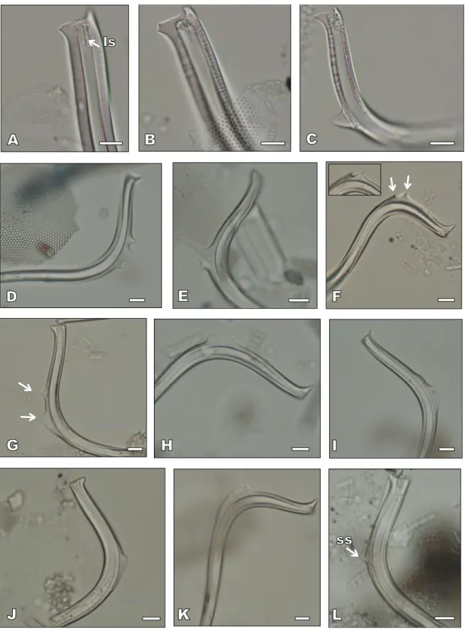 FIGURE 8. LM images of Proboscia barboi, P. curvirostris and intermediate forms. Scale bars= 10µm
