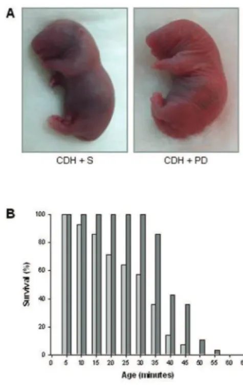 Table 2. Right ventricular hypertrophy evaluation 5 min after birth. a