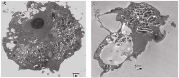 Figura  2  –  Infeção  por  Legionella  pneumophila  em  Acanthamoeba  polyphaga,  observada  através  de  microscópio eletrónico, 18 horas (a) e 48 horas (b) após o momento de infeção (retirado de Lau &amp; Ashbolt,  2009)