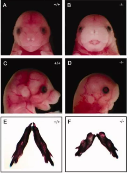Figura III - Camundongos Wnt5a - / - têm defeitos anatômicos fenotipicamente semelhantes a pacientes  com síndrome Robinow autossômica dominante