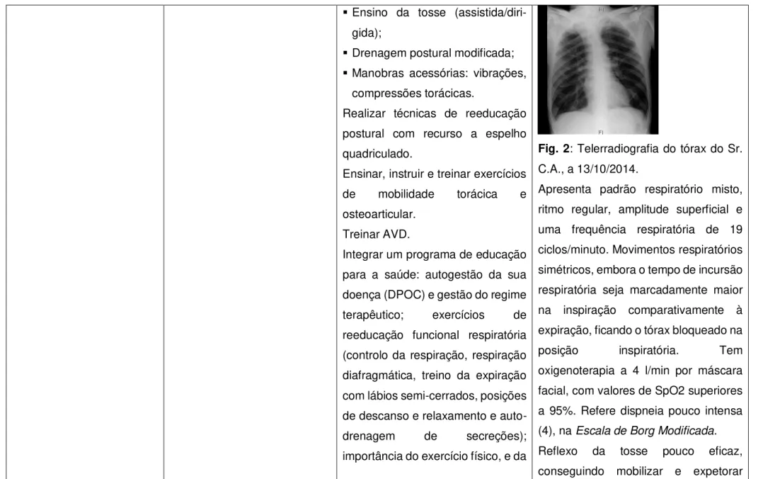 Fig. 2: Telerradiografia do tórax do Sr. 