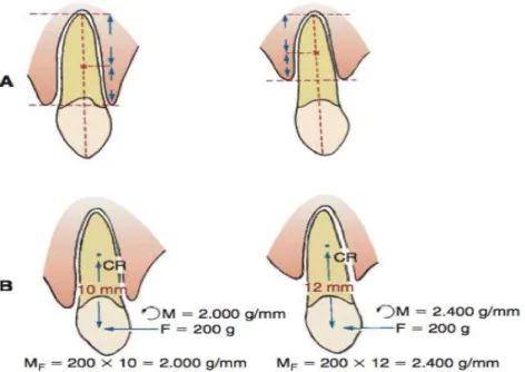 Figura  2  -  Modificação  do  posicionamento  do  centro  de  resistência  de  um  dente