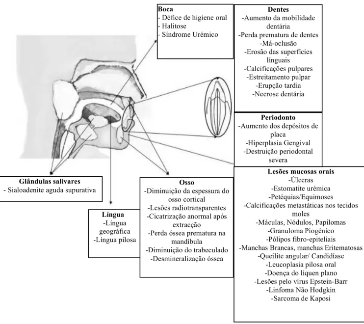 Figura 5. Problemas orofaciais comuns associados a Doença Renal Crónica ou causados pela terapia  (Figura adaptada de Akar, Akar, Carrero, Stenvinkel &amp; Lindholm , 2011)