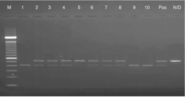 Figura  6  –  Análise  do  polimorfismo  Asn680Ser  do  gene  do  receptor  da  FSH  por  PCR-RFLP