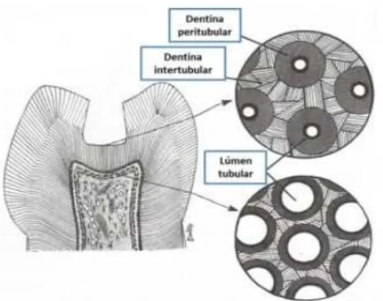 Figura 2 – Comparação entre a dentina peritubular e intertubular  próxima da JAD e  próxima da polpa