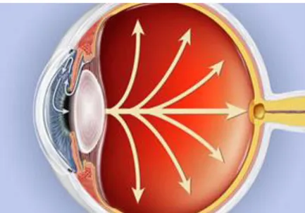 Figura 2.1: Estrutura anatómica de um olho identificado com glaucoma primário [11].