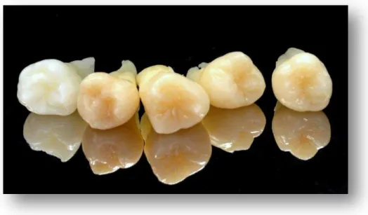 Figura 4- Fotografia dos dentes seleccionados para o estudo, após remoção de tecidos orgânicos 