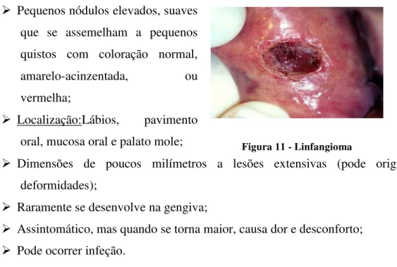 Figura 11 - Linfangioma 