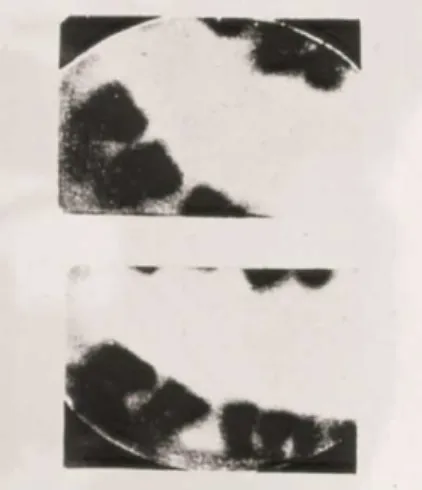 Figura  2 - Primeira radiografia dentária, executada pelo Dr.Otto Walkoff. Fonte: (Forrai, 2007)  
