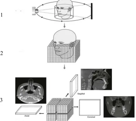 Figura  15- Etapas do processamento de imagem 