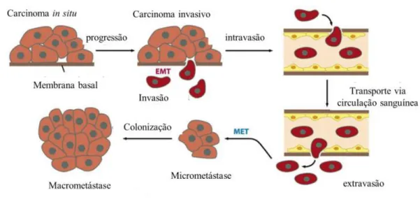 Figura 3 Processo de metástase e invasão de células cancerosas. Adaptado de: Labbé D. Les flavonoïdes  d’origine  alimentaire  et  le  cancer :  inhibition  de  l’angiogenèse  tumorale  et  du  potentiel  invasif  des  médulloblastomes