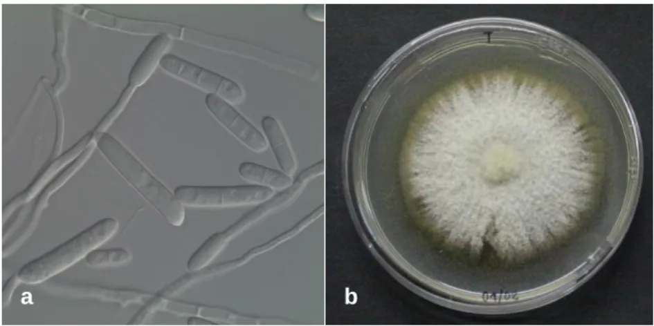 Figura 5: Ilyonectria macrodydima, isolado Cy244: a) ampliação 1000x (Fonte:Reis (2010); b)  crescimento micelial em PDA – cinco dias à temperatura ambiente (original da autora)
