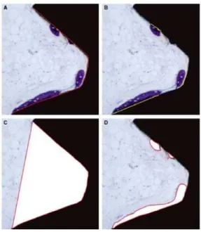 Figura 14 - Análise quantitativa da interface implante-osso (adaptado de Ocaña et al., 2016)