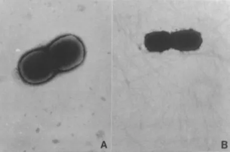 Figura 4 - Um diplobacilo sem fímbrias (A) e um diplobacilo com fímbrias (B). Imagens recolhidas por  microscopia eléctronica de transmissão