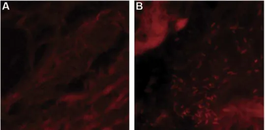 Fig. 2. Peptide nucleic acid–ﬂuorescence in situ hybridization (PNA–FISH) for H. pylori detection in adenoid and tonsil surgical specimens: (A) negative tonsil specimen; (B)H.