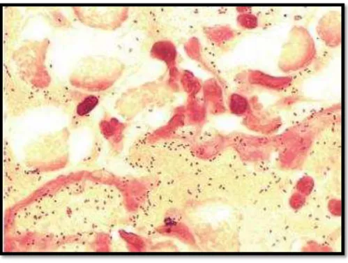Figura  1-  Haemophilus  influenzae (cocobacilos)  observados  em  esfregaço  com  coloração  de  Gram
