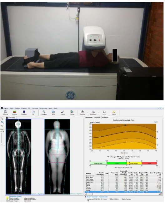 Figura 7. Registro fotográfico de uma voluntária durante a avaliação  de  DEXA.  Abaixo,  saída  gráfica  da  composição  corporal  da  voluntária avaliada